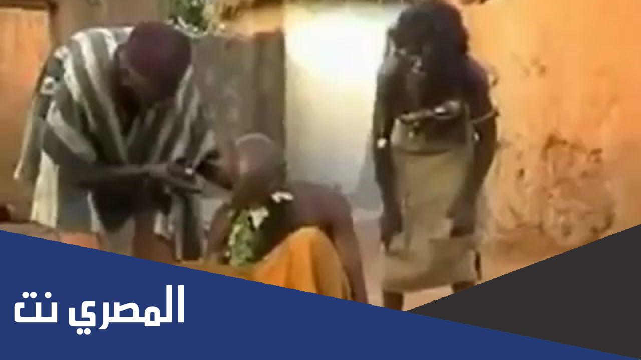 طريقة علاج الصداع في أفريقيا