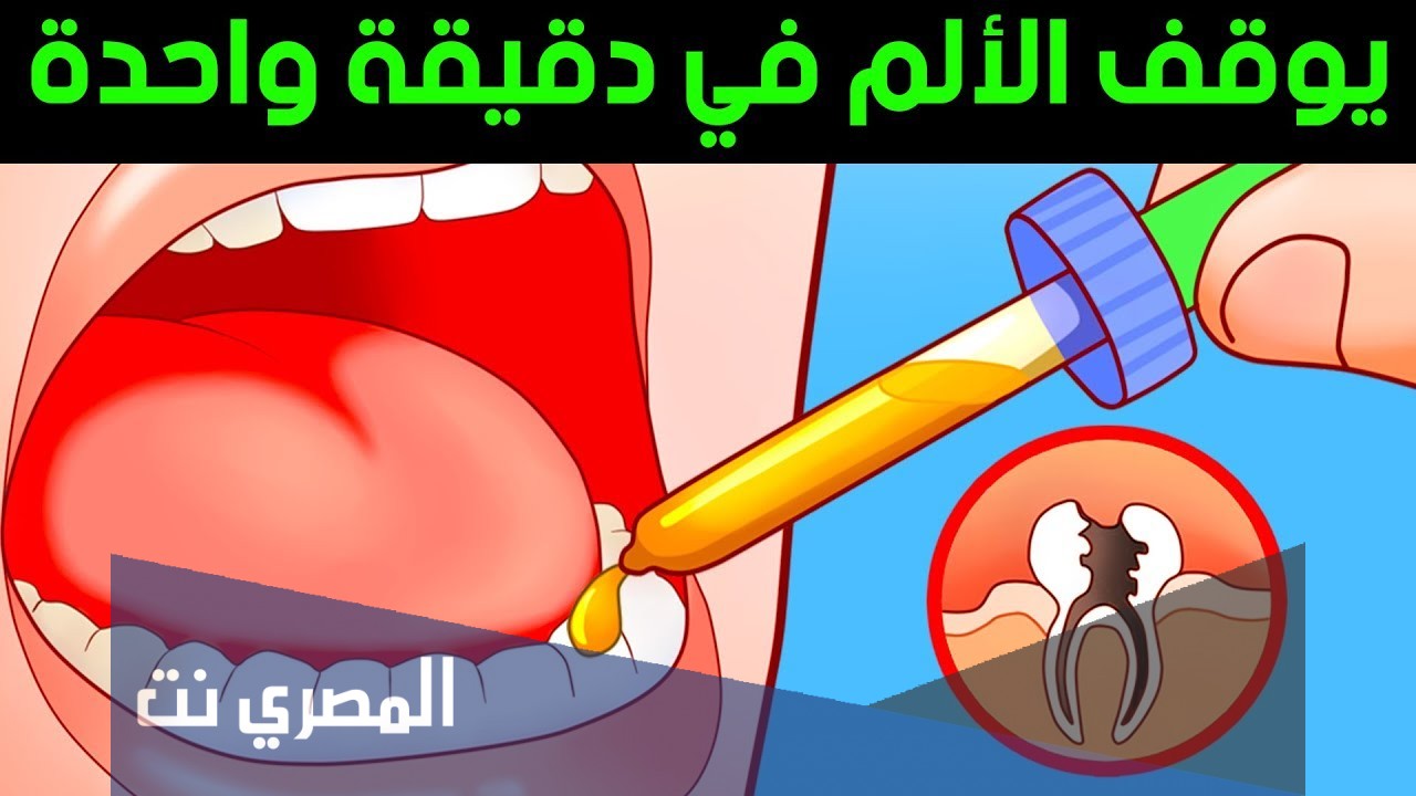 طريقة علاج وجع الاسنان
