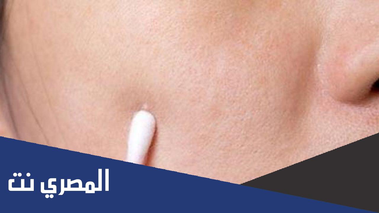 علاج البقع البيضاء في الوجه ونقص فيتامين