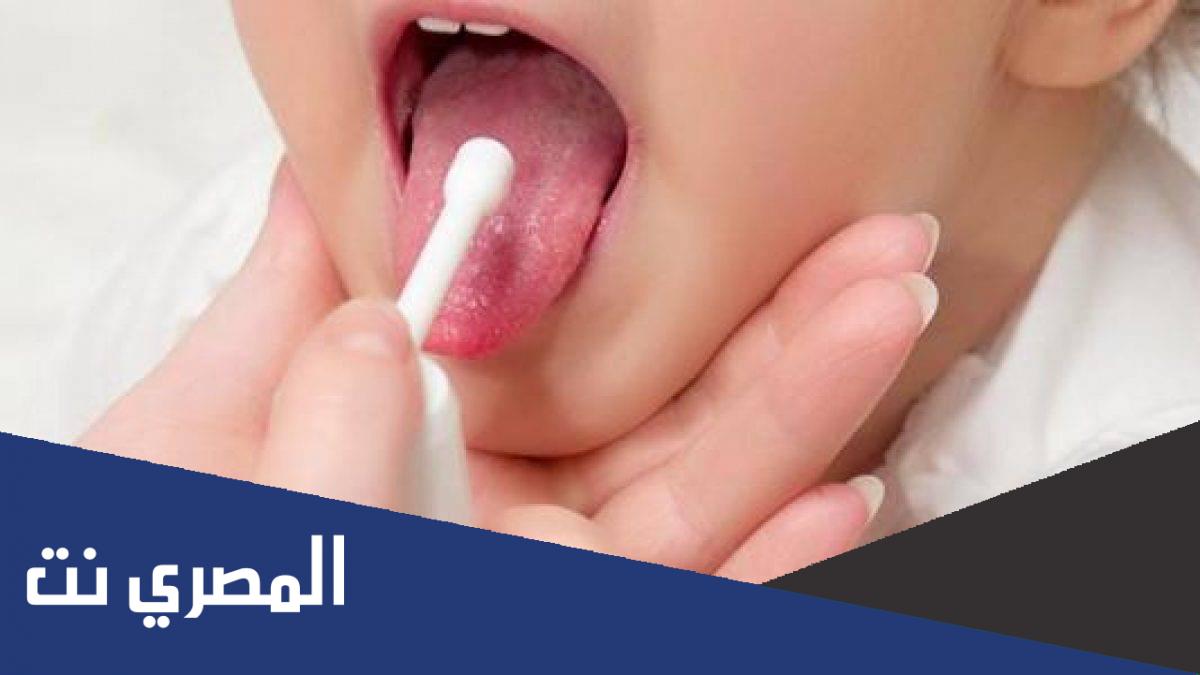 افضل ادوية التهاب الحلق للحامل والاطفال