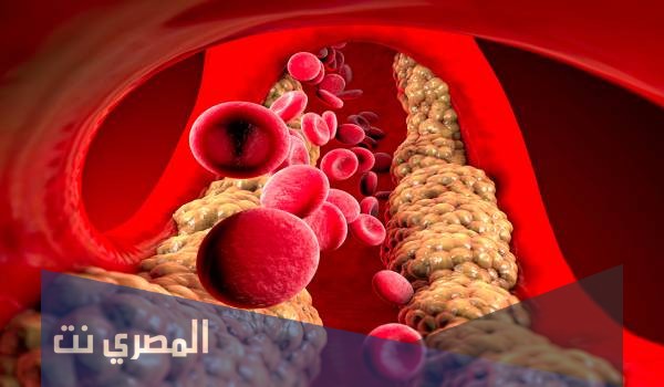 جيستيكول Justechol لخفض دهون الدم وتأثيره