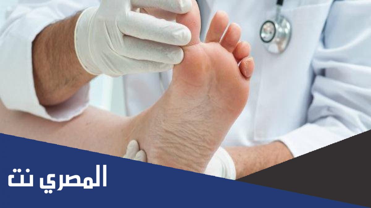 علاج الكالو وتورم الأصابع