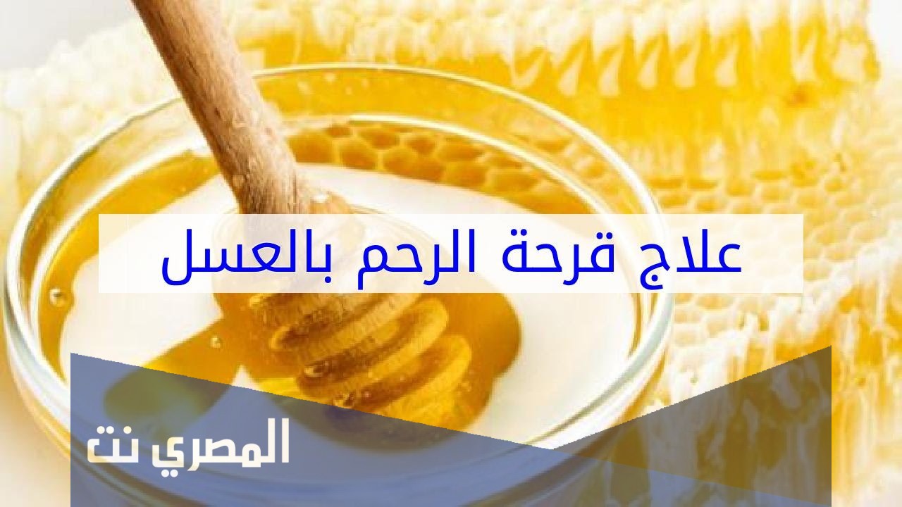 علاج قرحة الرحم بالعسل الطبيعي