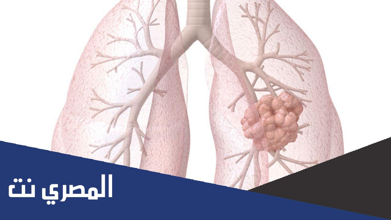 علاج مرض ذات الرئة