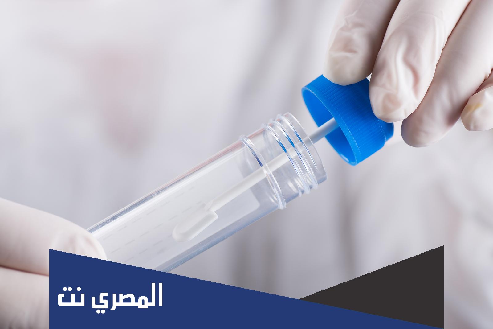 قراءة تحليل البراز بالتفصيل