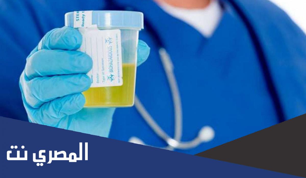 قراءة مزرعة البول خطوة بخطوة