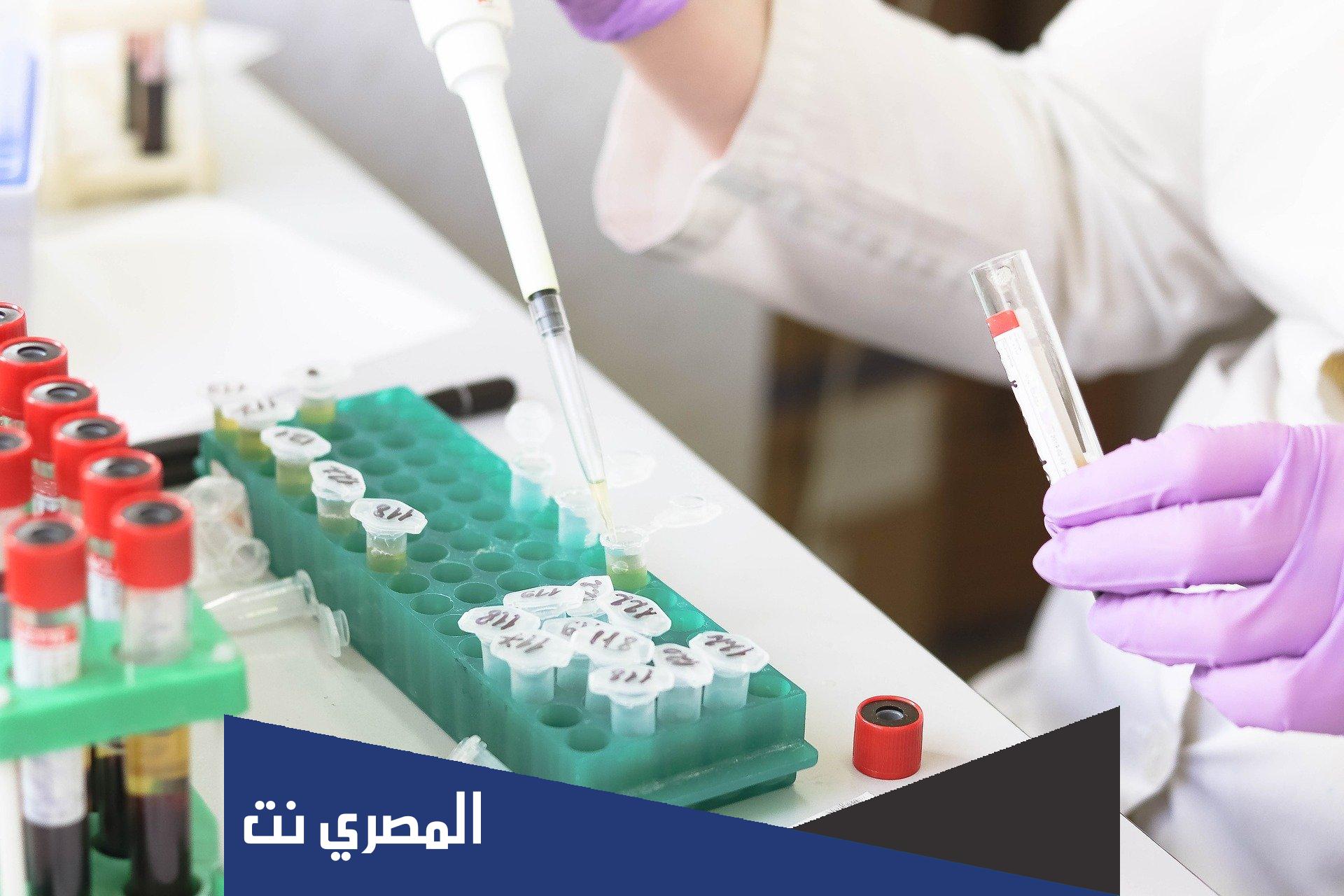 كم سعر تحليل فيتامين د في المختبر ؟