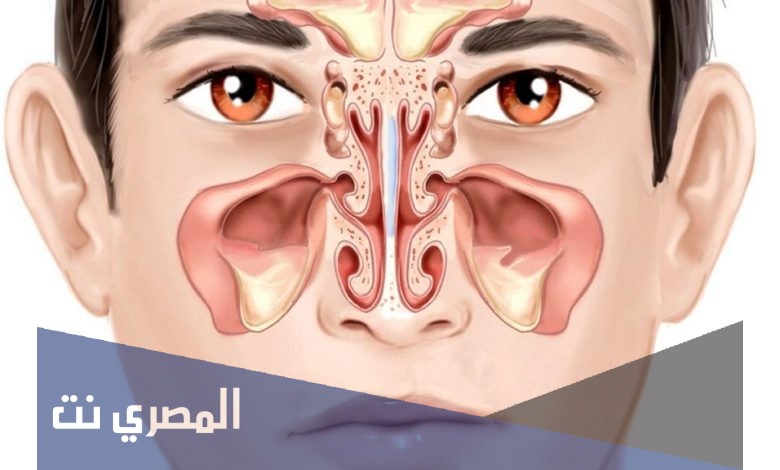 نيورين Neorin لعلاج التهابات الجيوب الأنفية وتأثيره
