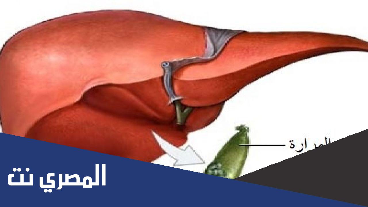 كيف تتشكل الحصى في المرارة