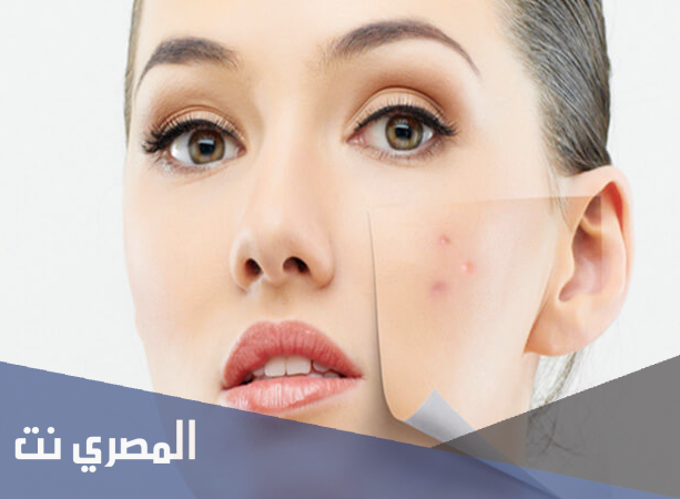 كيفية إزالة البقع الداكنة من الوجه وصفات طبيعية