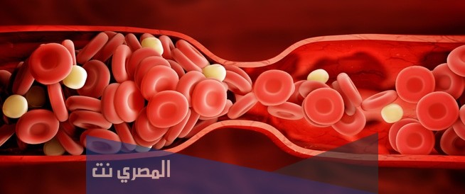 كيفية التعامل مع جلطات المخ فور حدوثها في المنزل