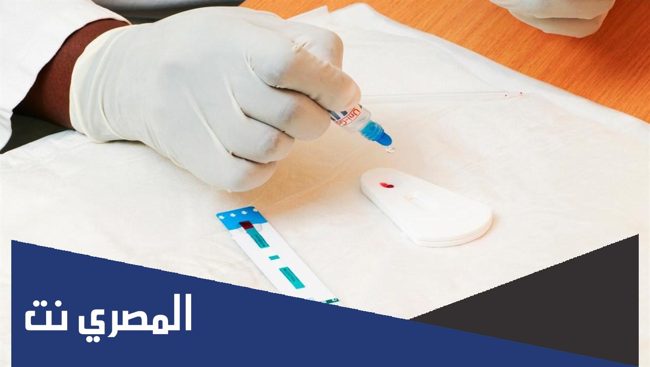 كيفية الكشف عن مرض الإيدز