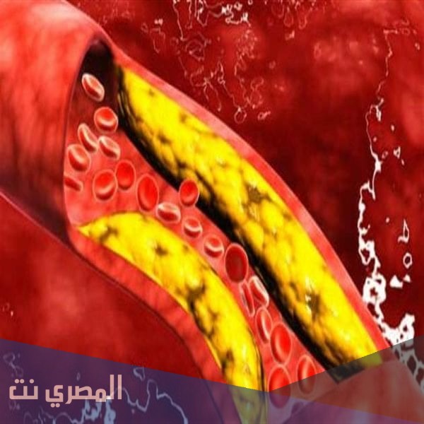 كيفية تقليل نسبة الدهون في الدم