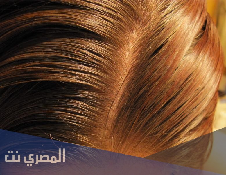 كيفية عمل صبغة الشعر بالكركم