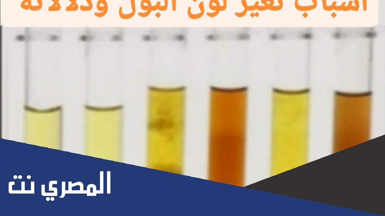 ما أسباب تغير لون البول ؟