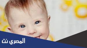 ما أسباب ولادة الطفل منغولي؟