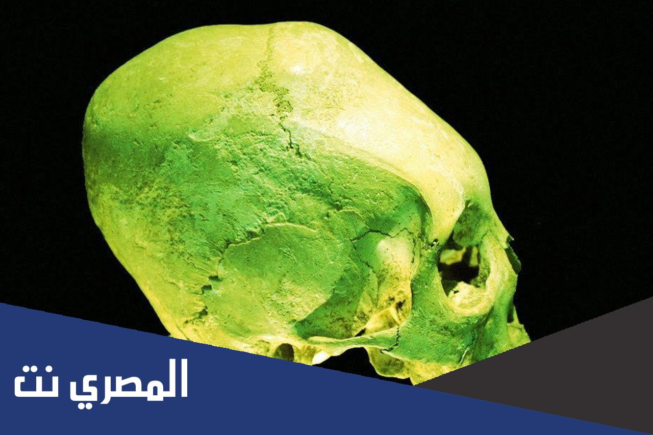 ما الذي يميز عظام الجمجمة