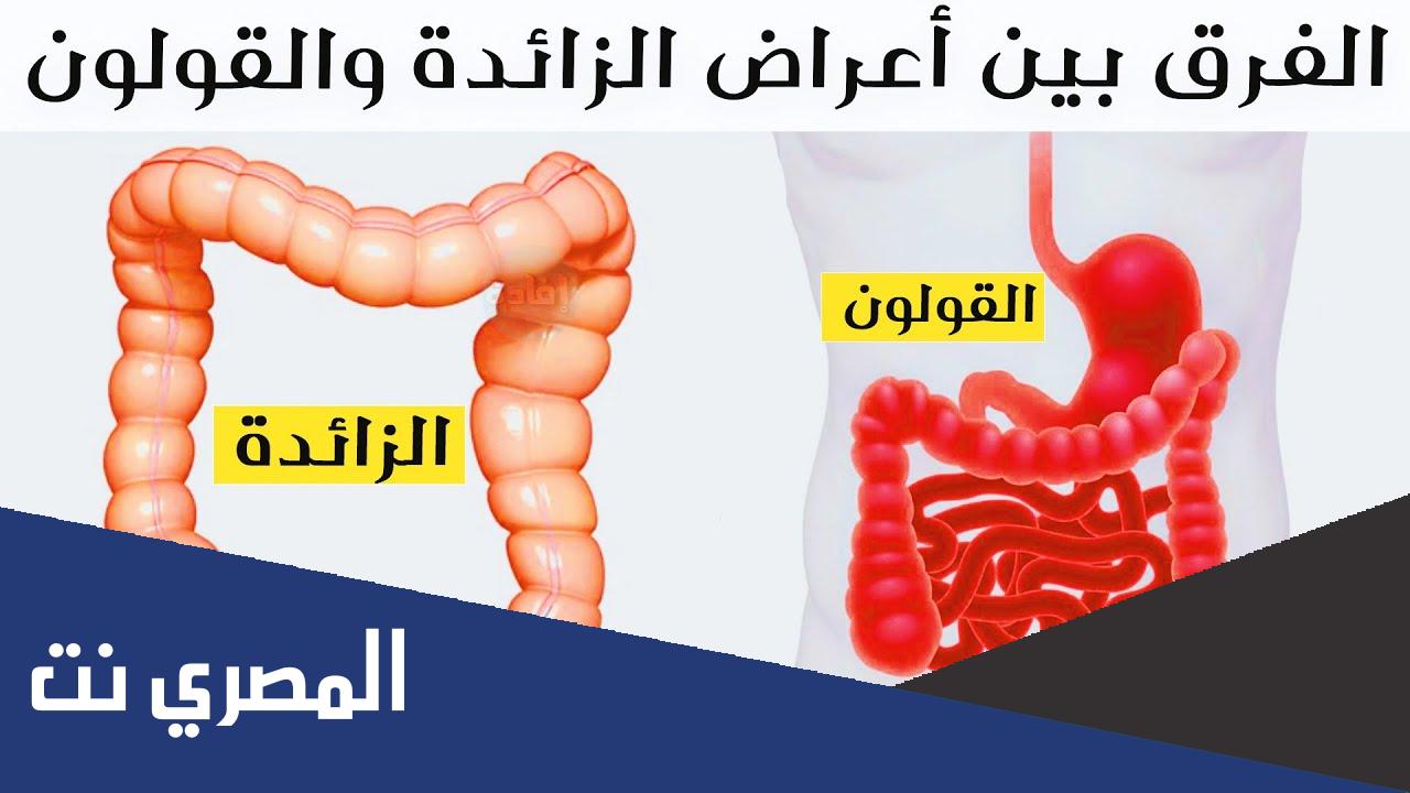 ما الفرق بين اعراض الزائدة والقولون ؟