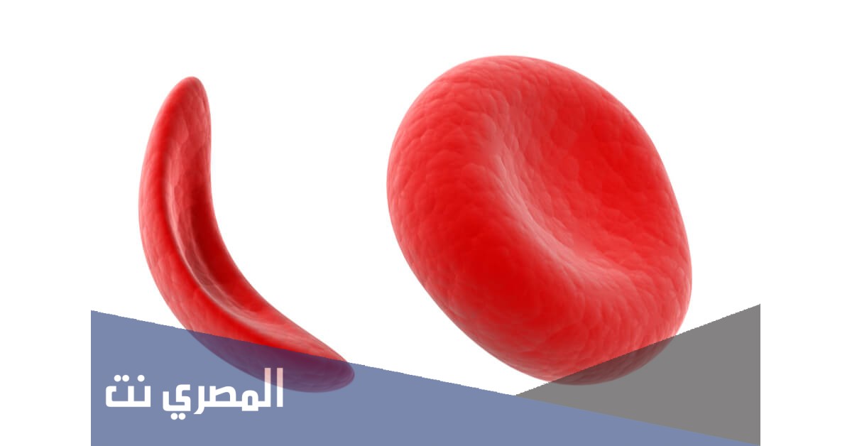 ما الفرق بين حامل الأنيميا والمصاب