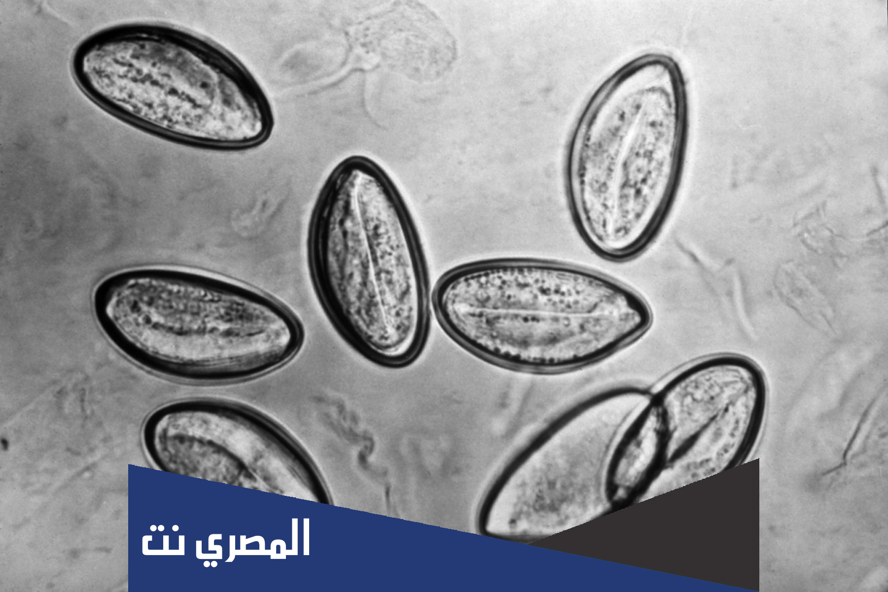 ما معنى داء السرميات عند الانسان