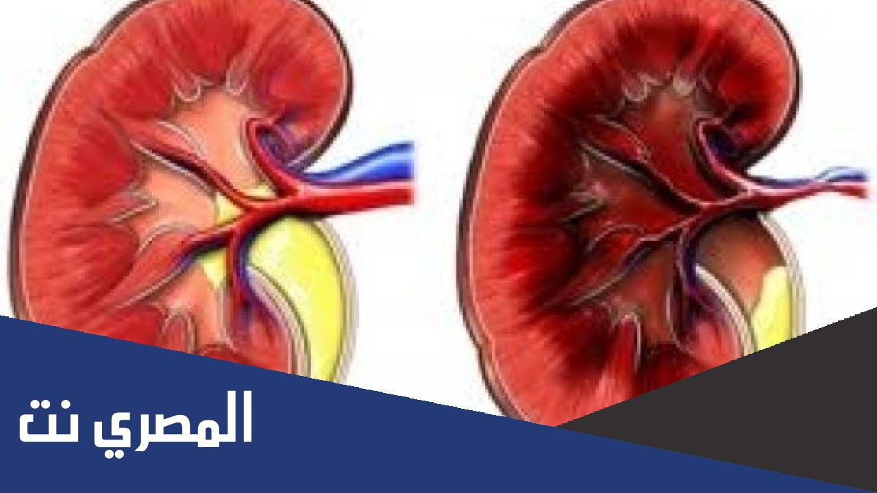 ما هو التليف في الكلى ؟