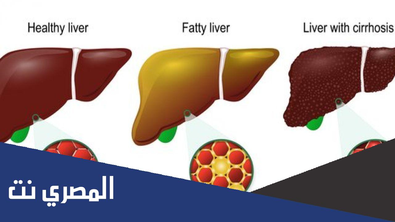 ما هو علاج تليف الكبد