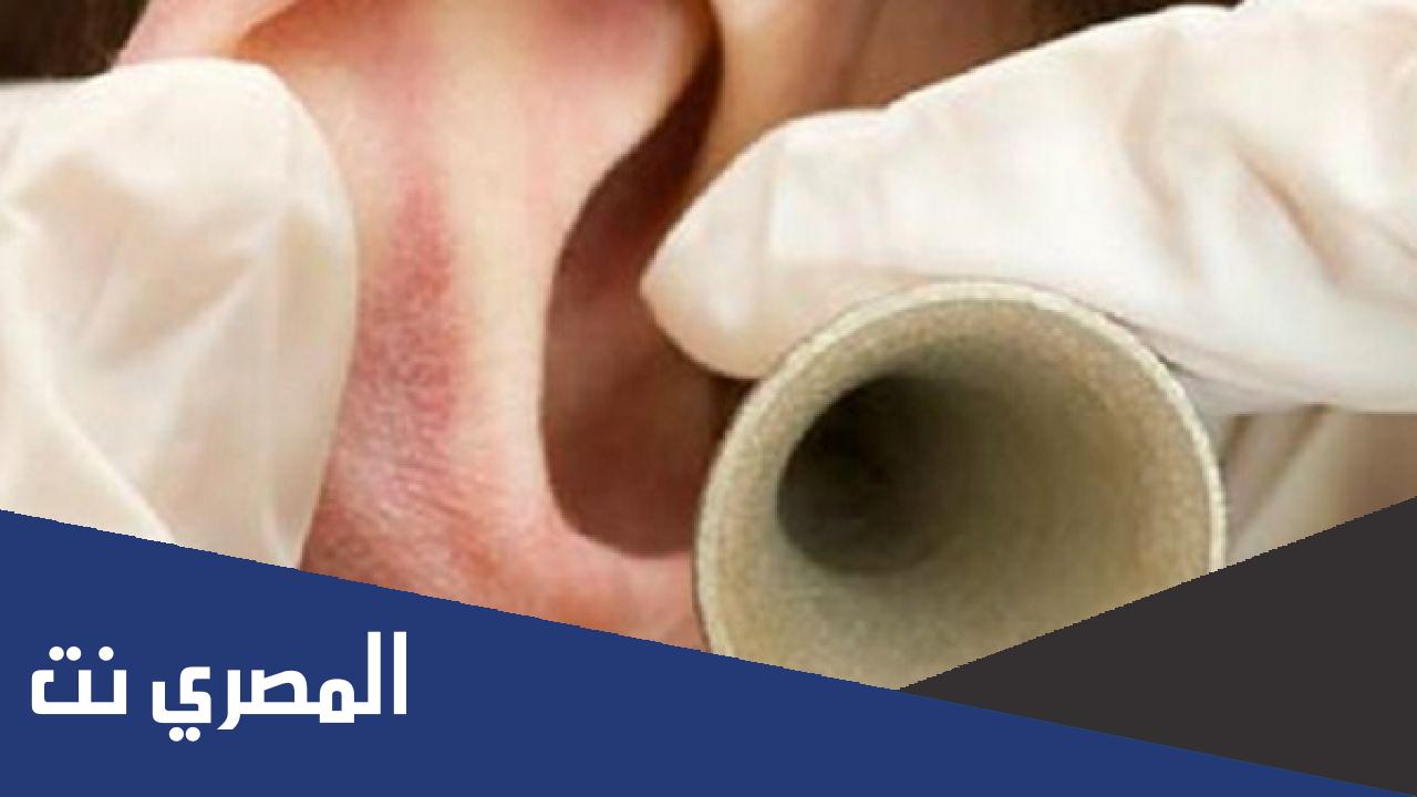 ما هو علاج ضعف السمع بالخلايا الجذعية ؟