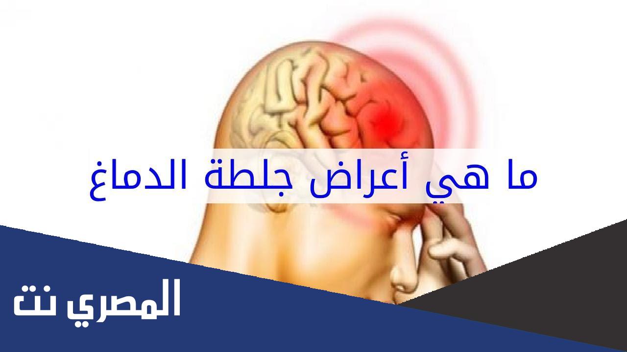 ما هي أسباب الجلطات الدماغية