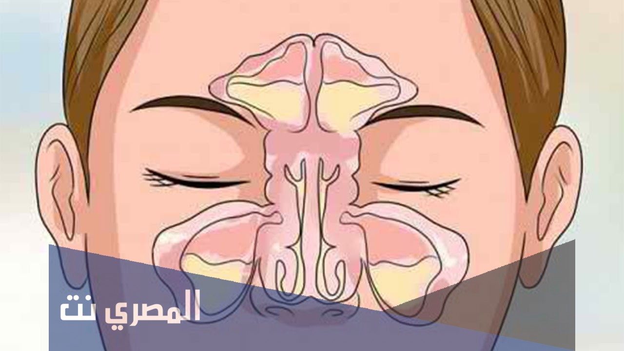 ما هي أسباب انسداد الأنف