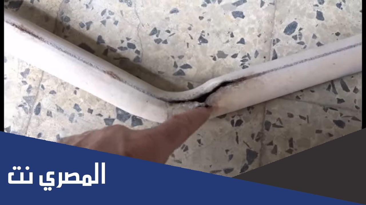 ما هي أضرار ثقب الشكمان ؟