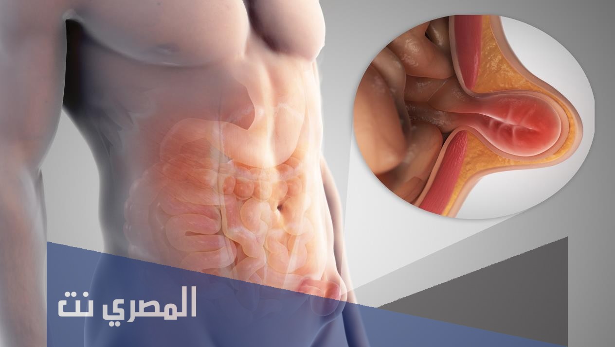 ما هي أعراض فتق الخصية ؟