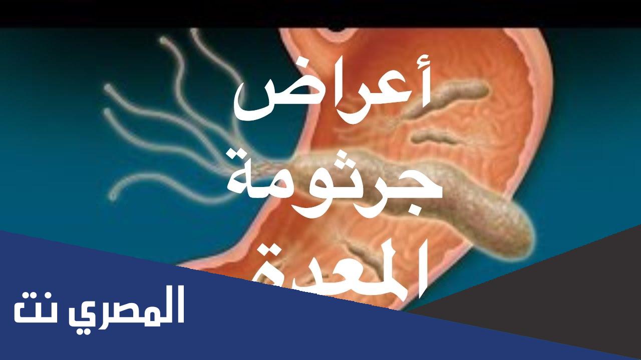 ما هي بكتيريا المعدة وما علاجها ؟