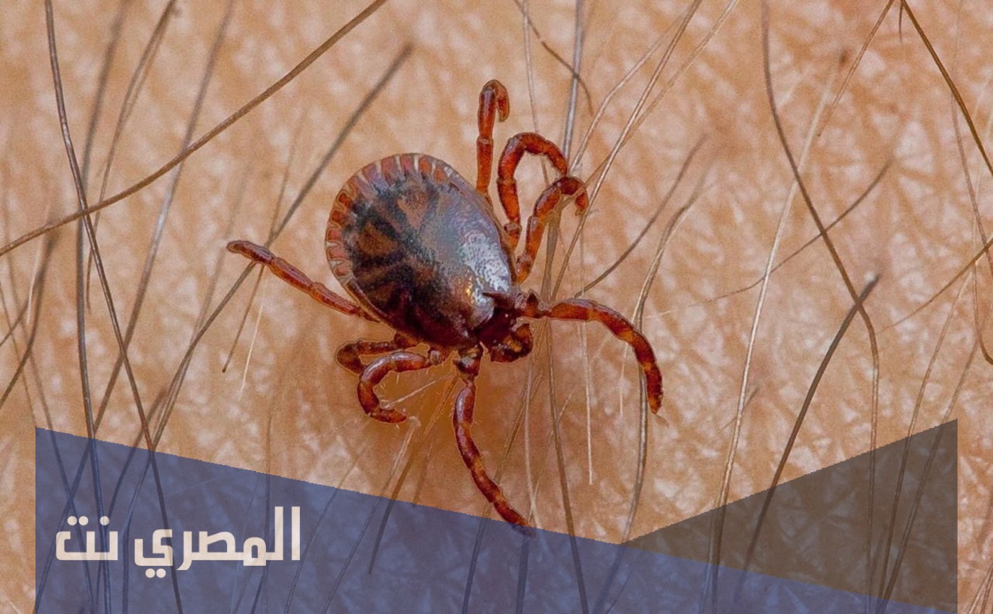 ما هي حمى القرم الكونغو النزفية ويكيبيديا
