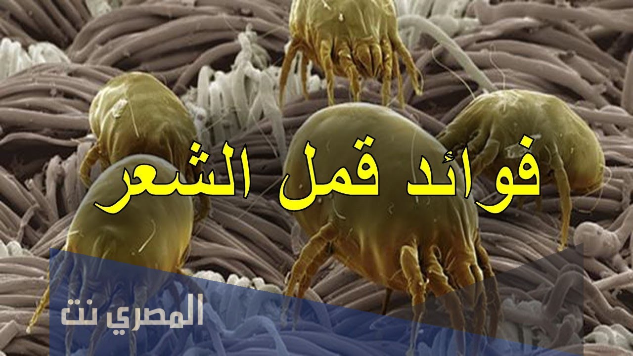 ما هي فوائد قمل الشعر