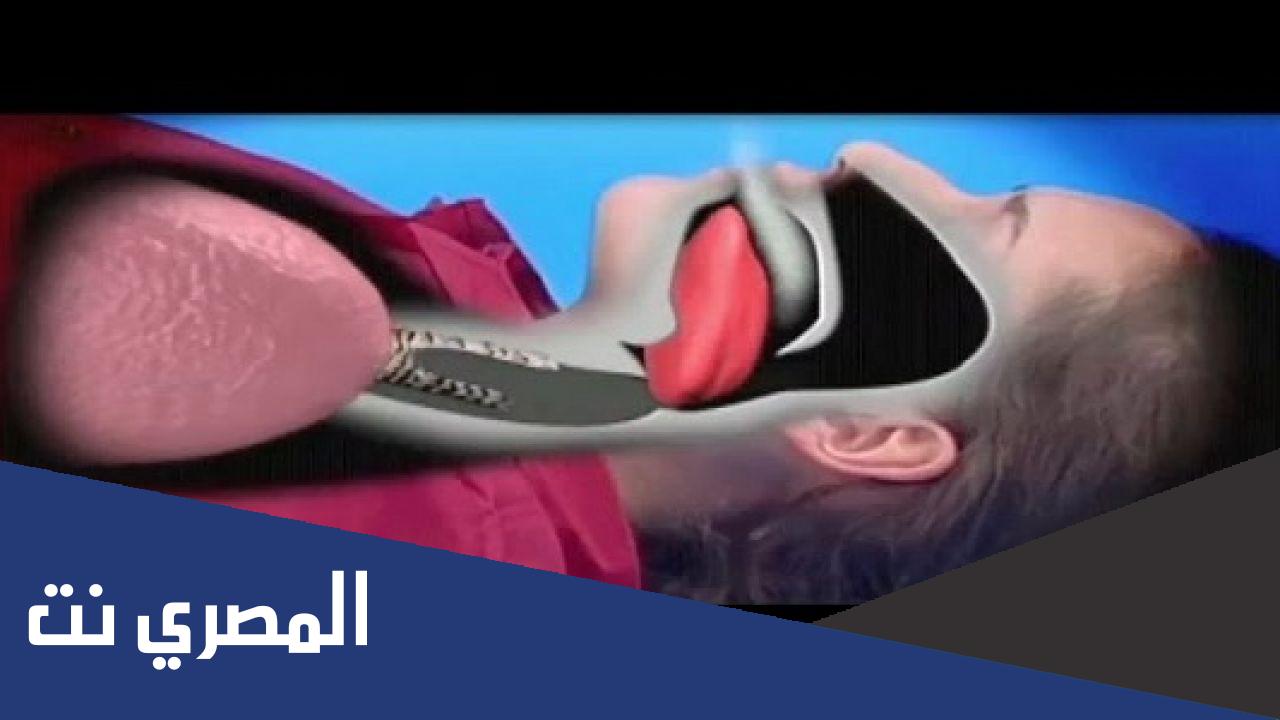 معلومات عن بلع اللسان وكيفية التعامل معه