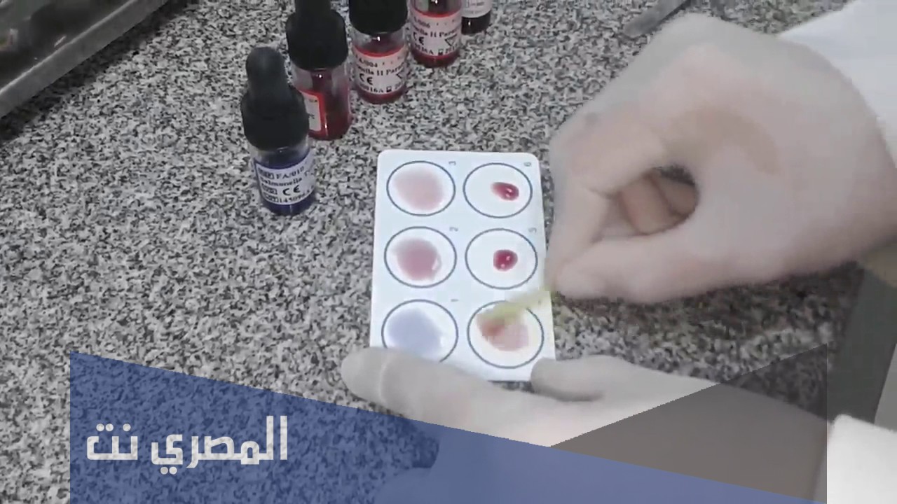 معلومات عن تحليل التيفود