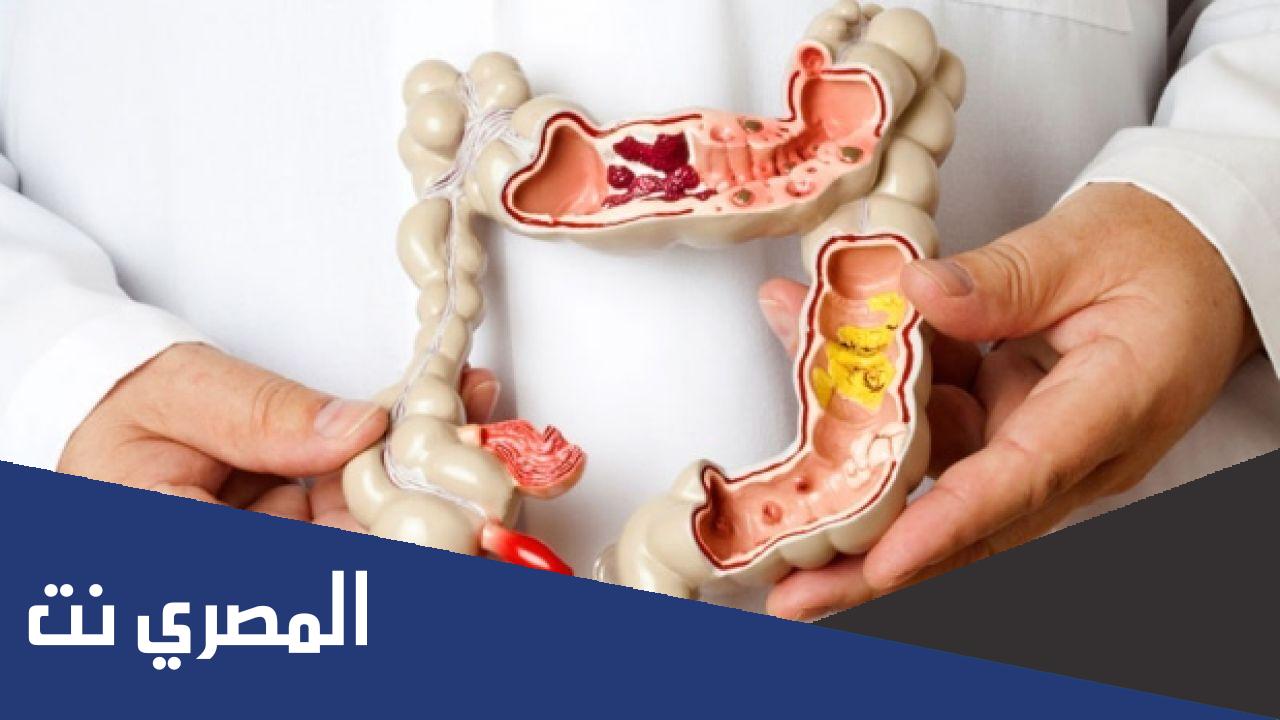 نصائح للتعامل مع القولون