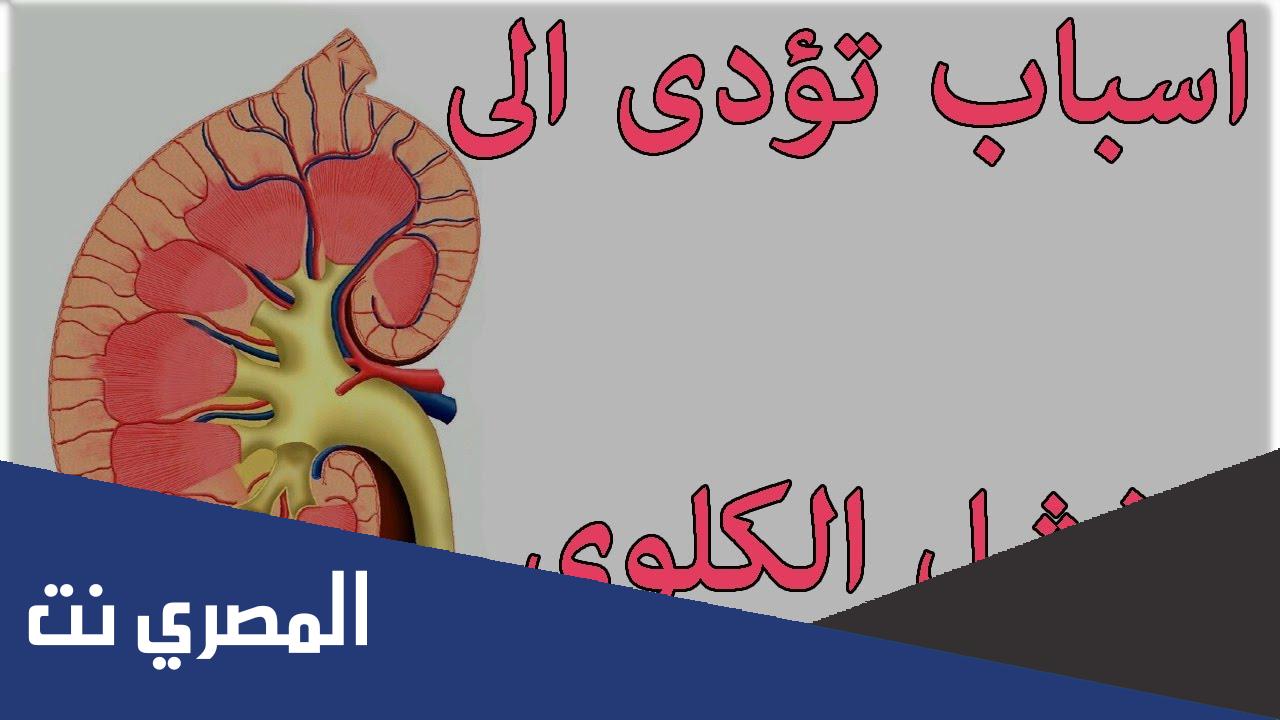هل حصوات الكلى تسبب فشل كلوي بالتفصيل ؟