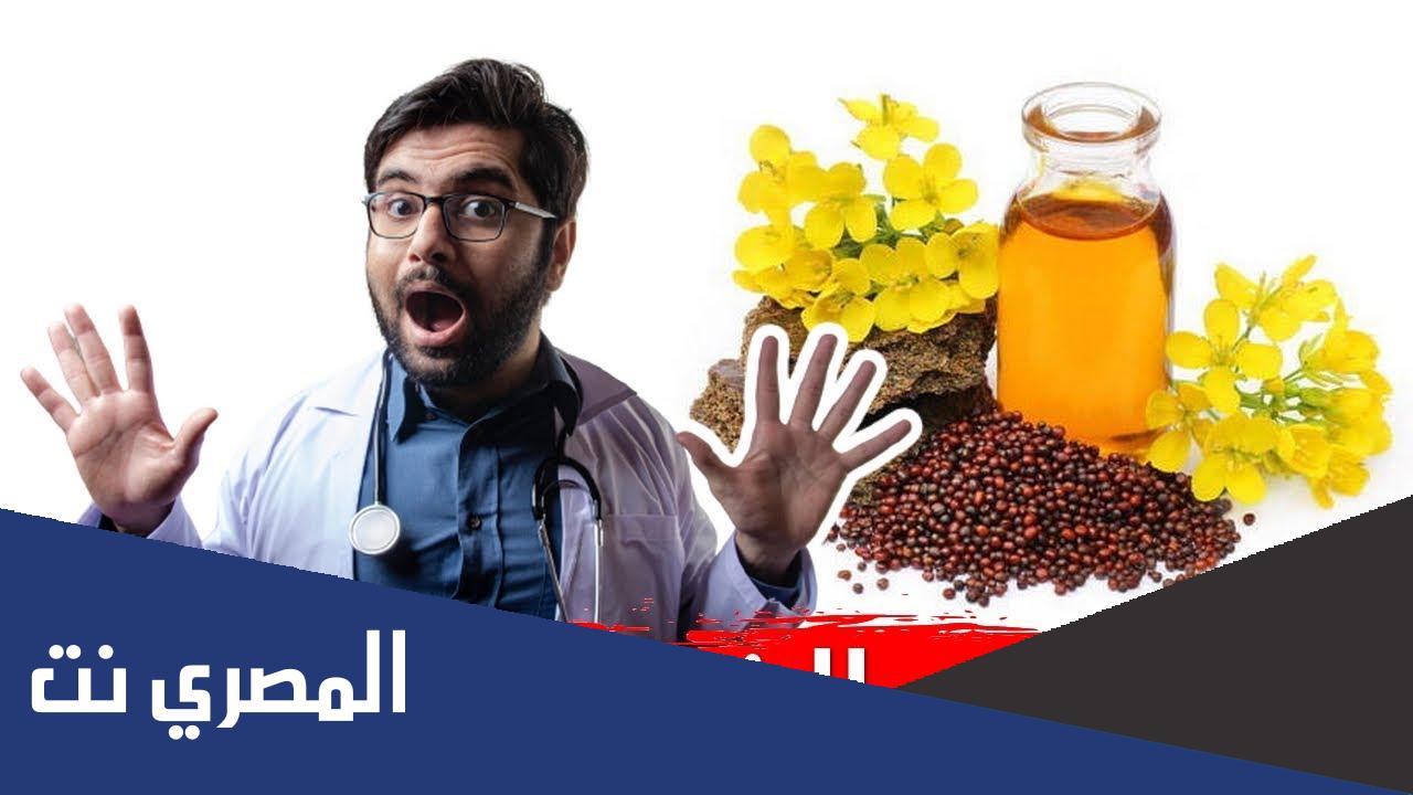 هل زيت الخردل مفيد للدوالي