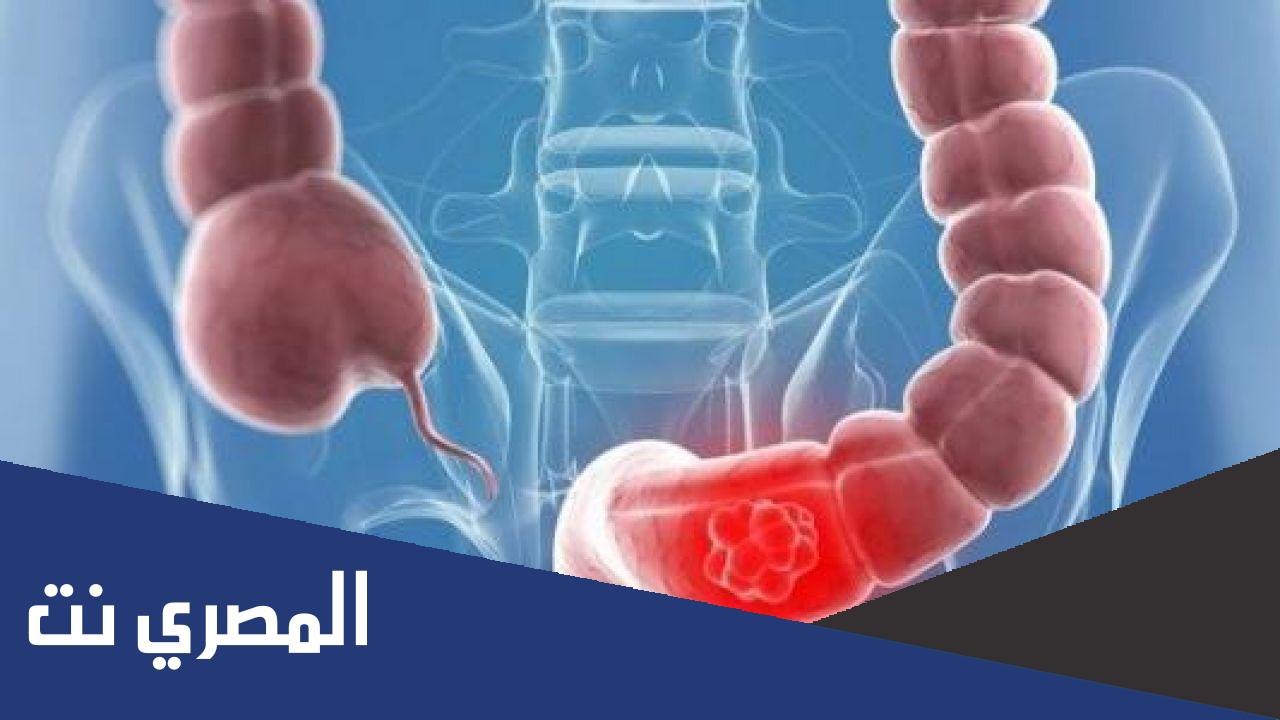 هل يسبب القولون ألم الظهر ؟
