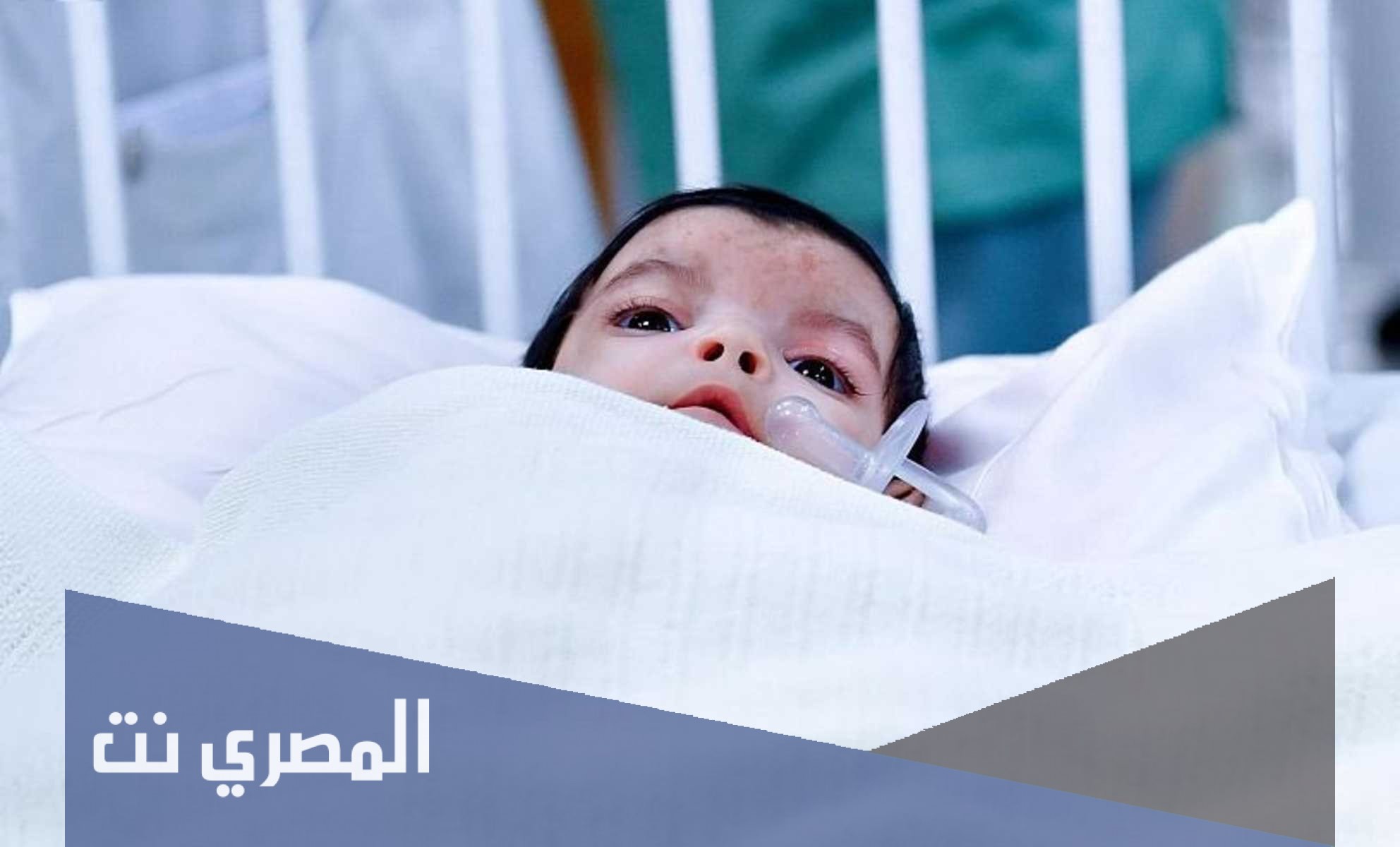 وش معنى توأم طفيلي