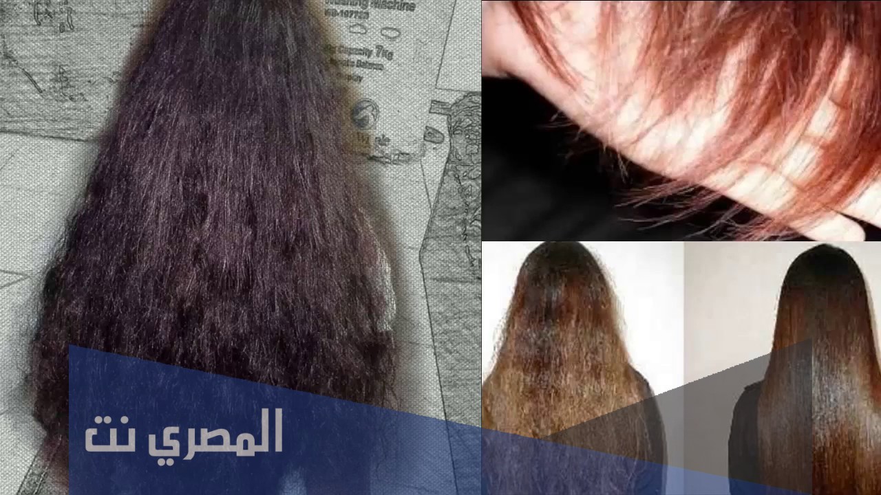 وصفة لعلاج تقصف الشعر الشديد