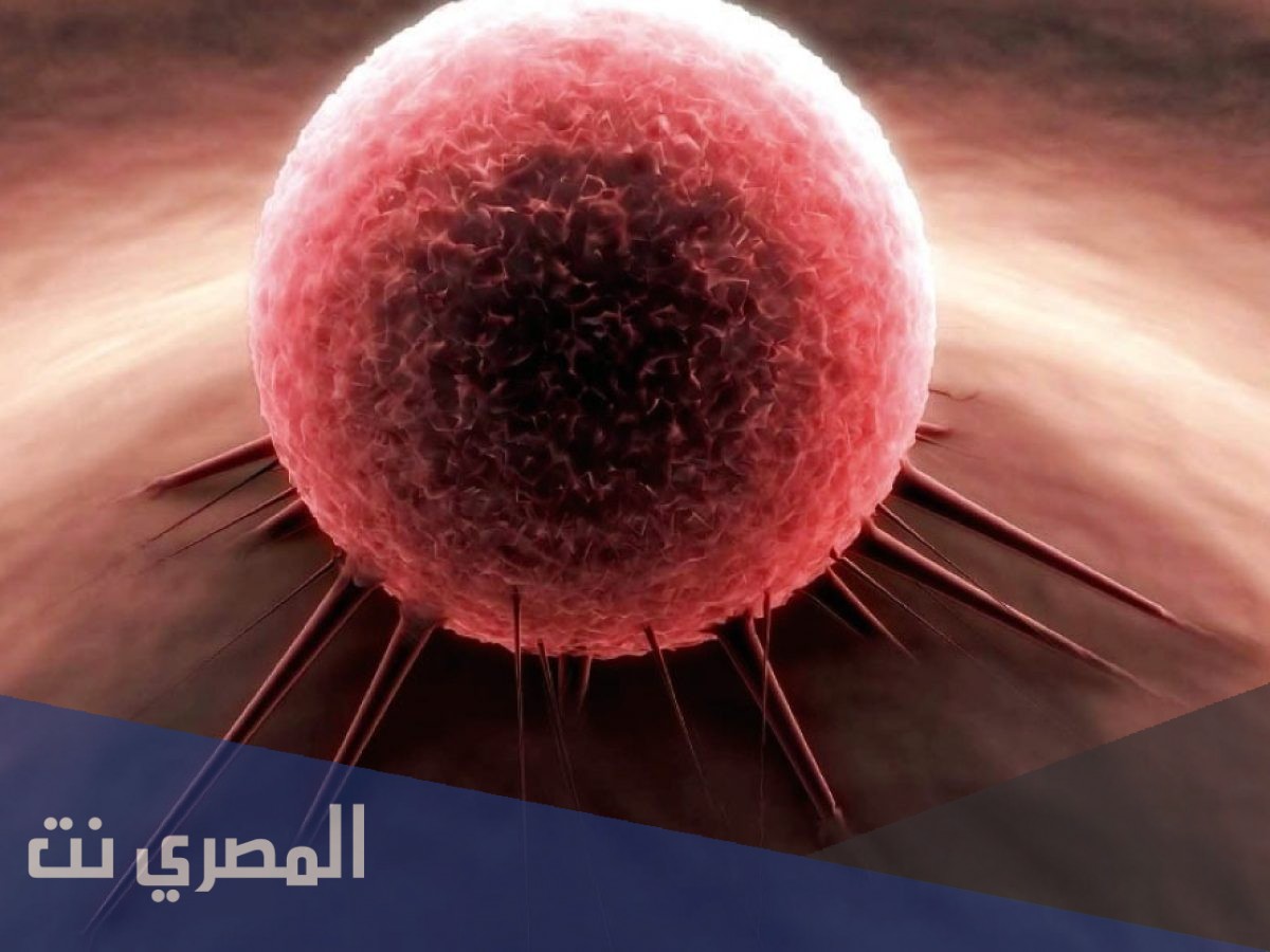 ما هو مرض الجمرة الخبيثة