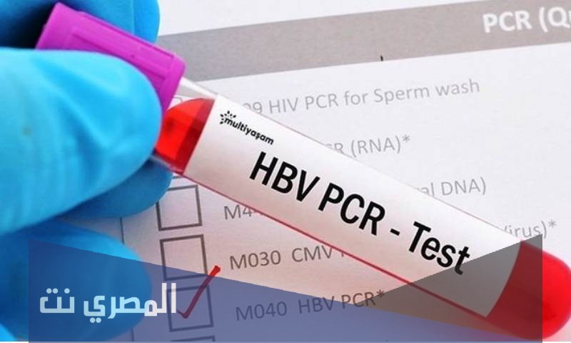 كم اسعار تحليل pcr في جدة