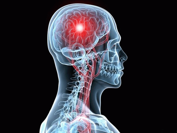 بلافيكارد Plavicard لعلاج السكتات الدماغية وتأثيره