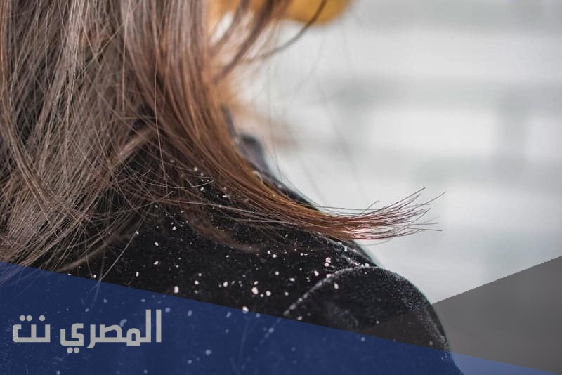 شامبو كيتورال بلس Kitoral Plus لعلاج قشرة الرأس وتأثيره