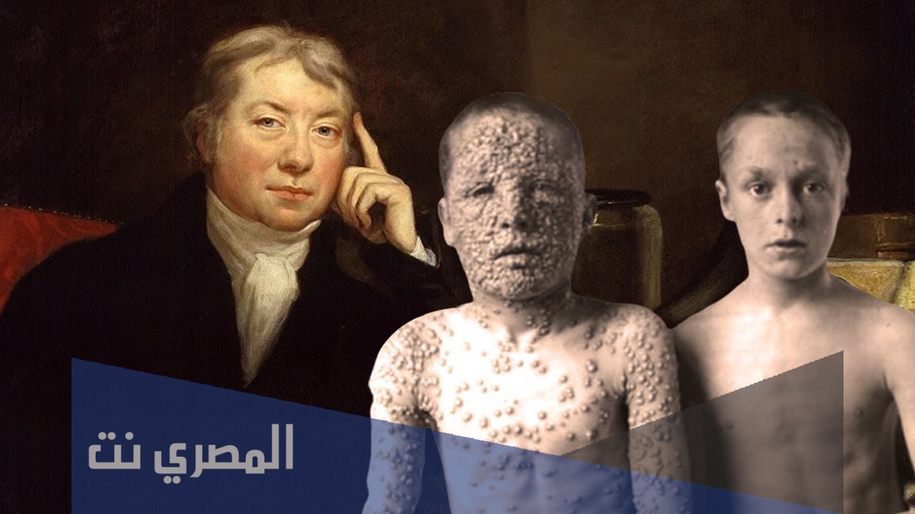 من اكتشف التلقيح ضد الجدري