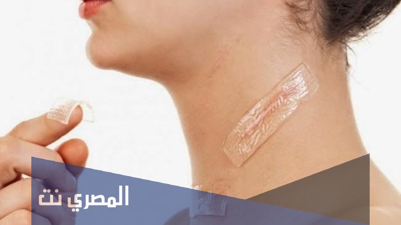 كريم بيافين Biaphine لعلاج الحروق والندوب وتأثيره