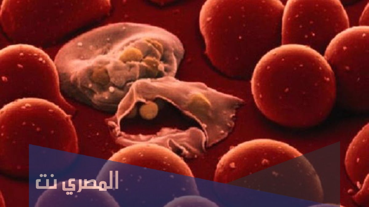 أسباب وجود طفيليات في الأمعاء