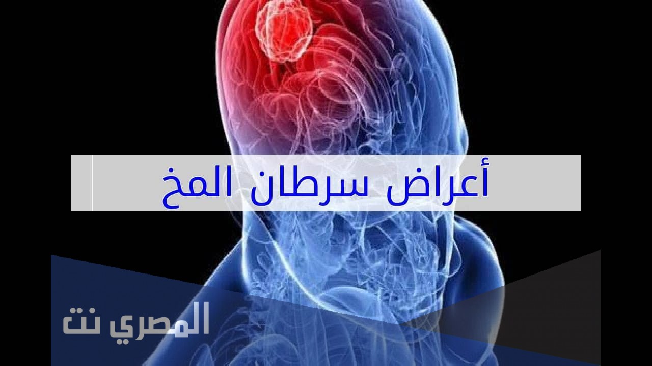 أعراض سرطان المخ بالتفصيل